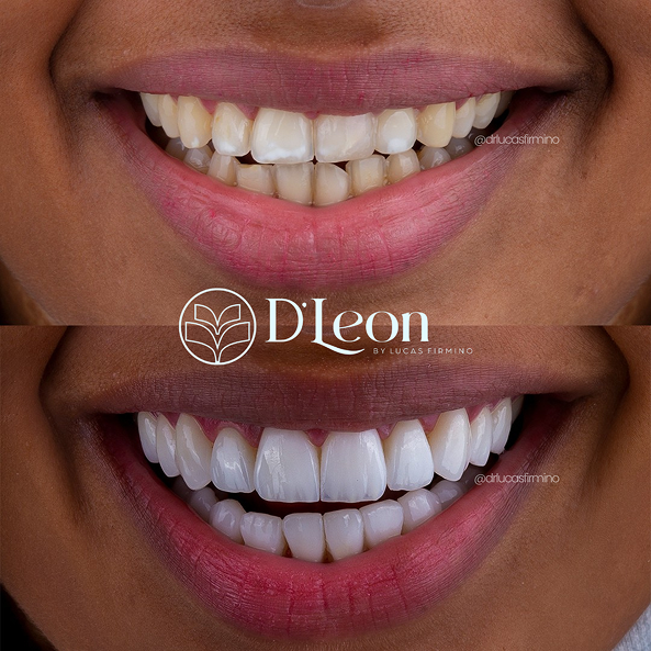 Cópia de @drlucasfirmino (1) (1)21