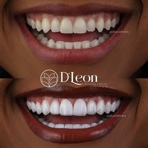 Cópia de @drlucasfirmino (1) (1)23