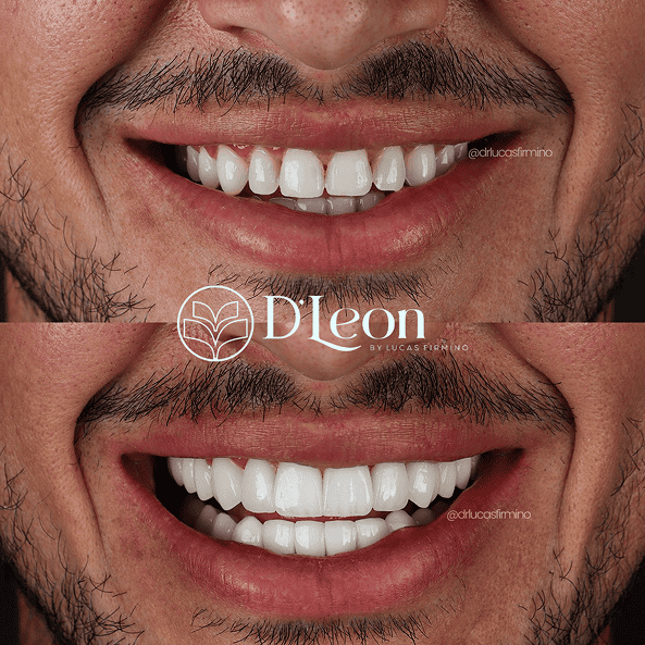 Cópia de @drlucasfirmino (1) (1)24