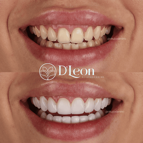 Cópia de @drlucasfirmino (1) (1)25