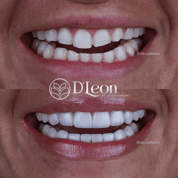 Cópia de @drlucasfirmino (1) (1)26