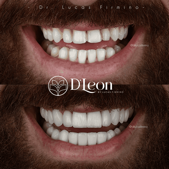 Cópia de @drlucasfirmino (1) (1)27